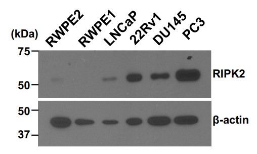 Comparison of RIPK2 protein levels in six commonly used prostate cell line models.jpg